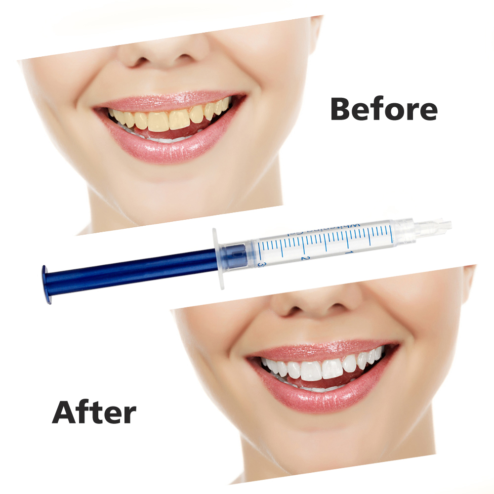 Teeth Whitening Oral Gel Polish Pen Kits Peroxide Professional Bleaching Dental Hygiene Care Tools Tooth Whitener with LED Light Teeth Whitening Oral Gel Polish Pen Kits Peroxide Professional Bleaching Dental Hygiene Care Tools Tooth Whitener with LED Light