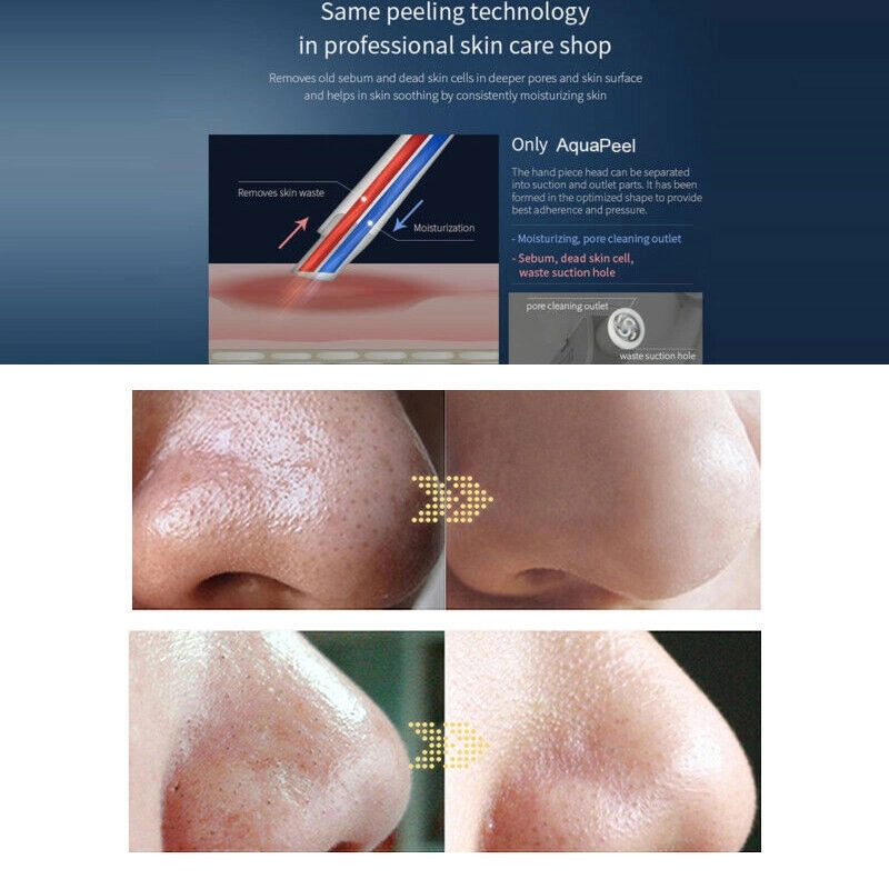 Hydra Dermabras oxygen jet peel clean machine Microdermabrasion Water Oxygen Therapy Facial Equipment Facial Skin Whitening Hydra Dermabras oxygen jet peel clean machine Microdermabrasion Water Oxygen Therapy Facial Equipment Facial Skin Whitening